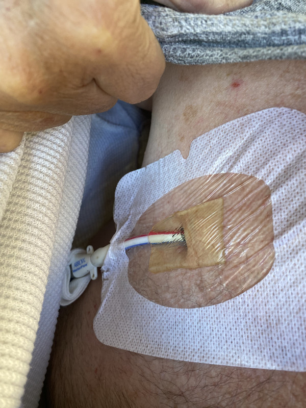 44B84742-1341-4D65-A082-65B9A2570DFD