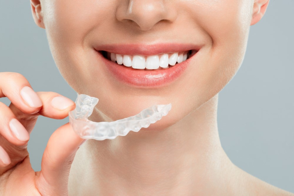Foods to Avoid During Invisalign Dubai Treatment