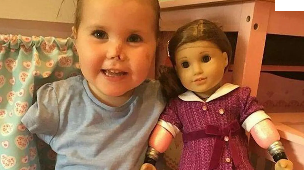 Niña amputada de sus cuatro extremidades gana demanda millonaria