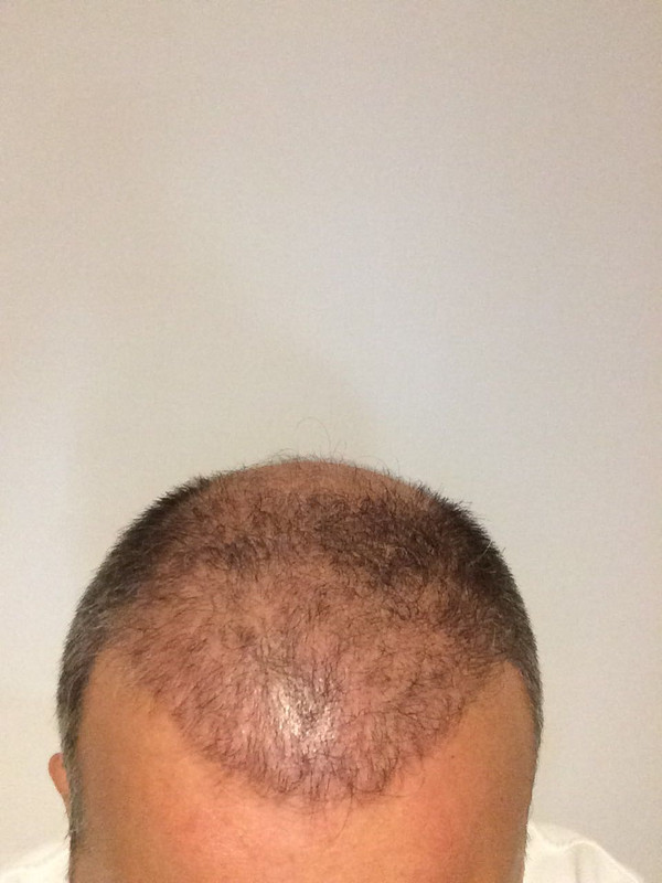 WhatsApp Image 2017-07-17 at 20.52.19