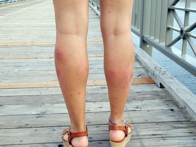 Sucrerie de la Montagne y Parc Omega - DOS SEMANAS EN EL ESTE DE CANADÁ (ONTARIO Y QUÉBEC) (2)