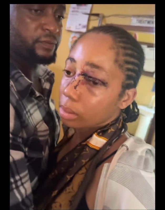 Lagos Assault Case: Suspect Reportedly Remanded Pending Further Court Proceedings