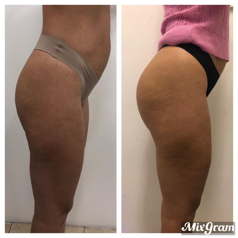 Projeto 8