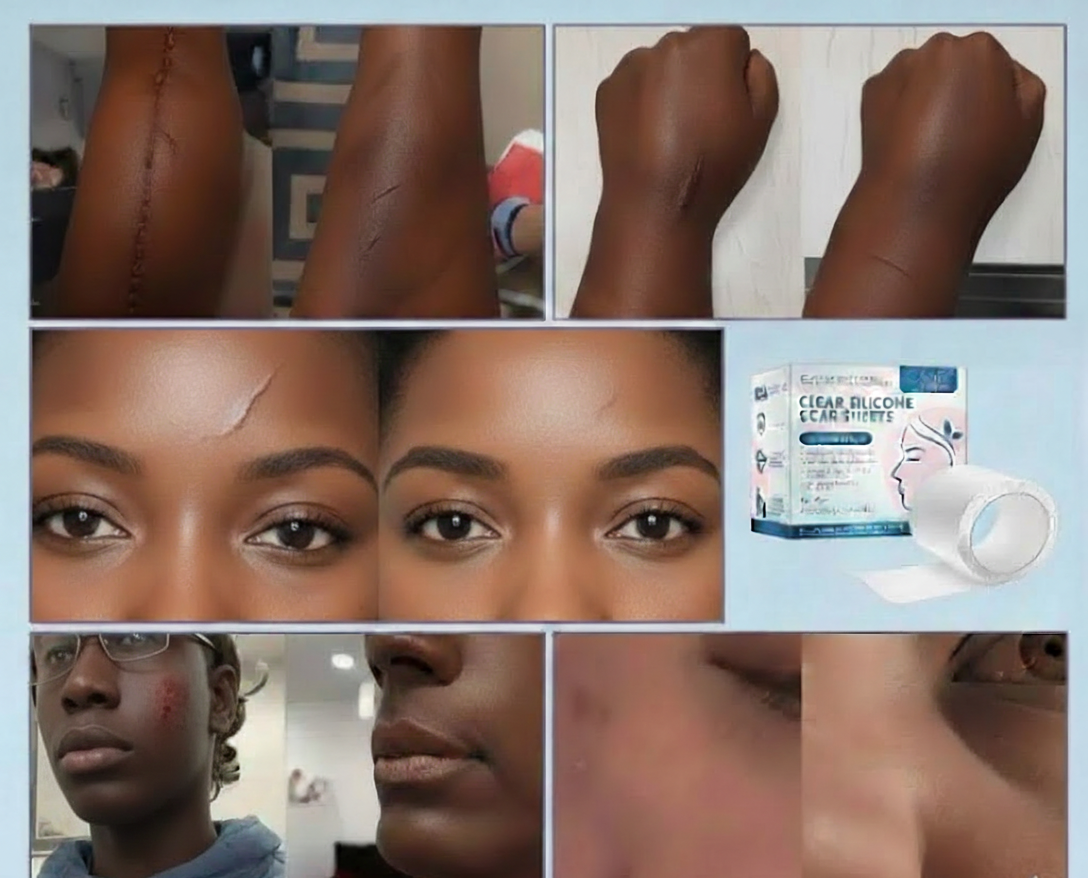 Skin concerns illustration