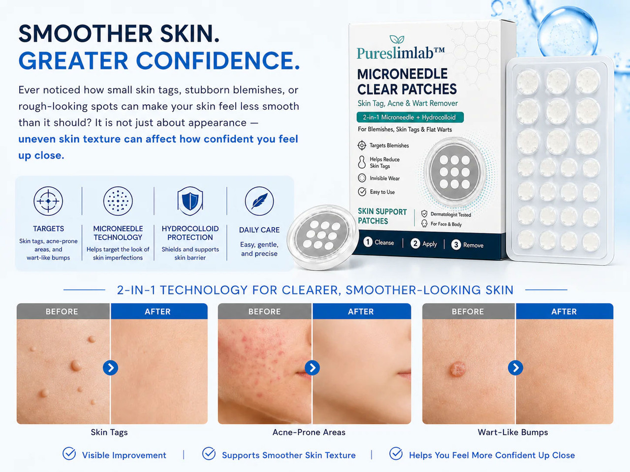 Tealisu Microneedle Clear Patches
