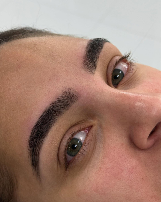 Tratamiento facial