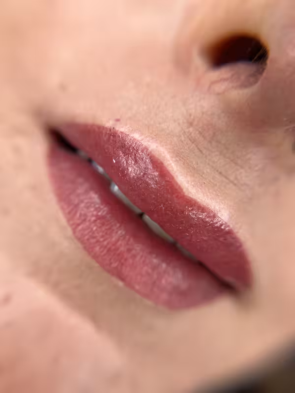 Popis obrázku