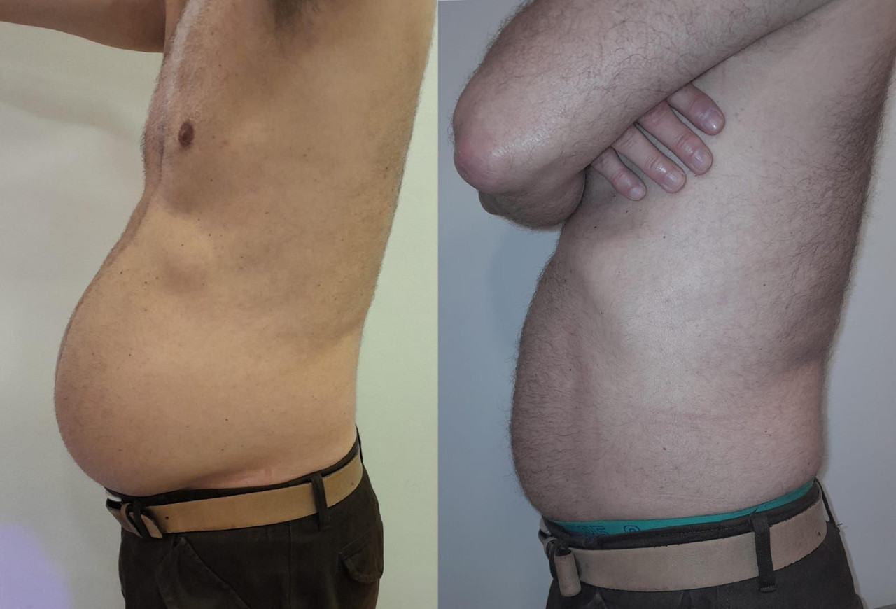 Projeto 10