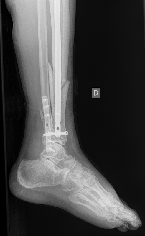 22 12 25 golen lat 3