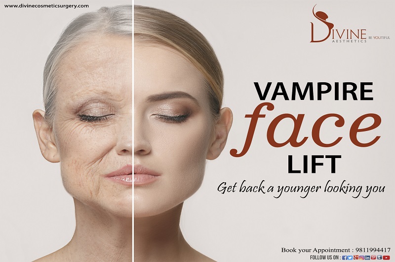 Vampire Facelift 
