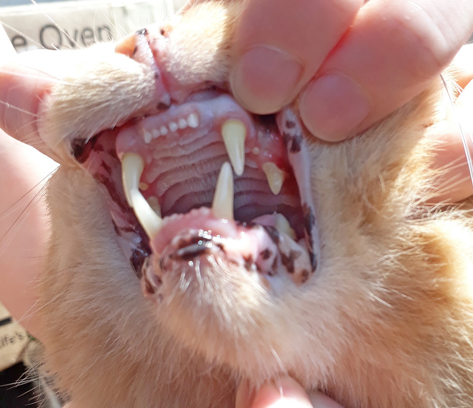 Гингивит_верх