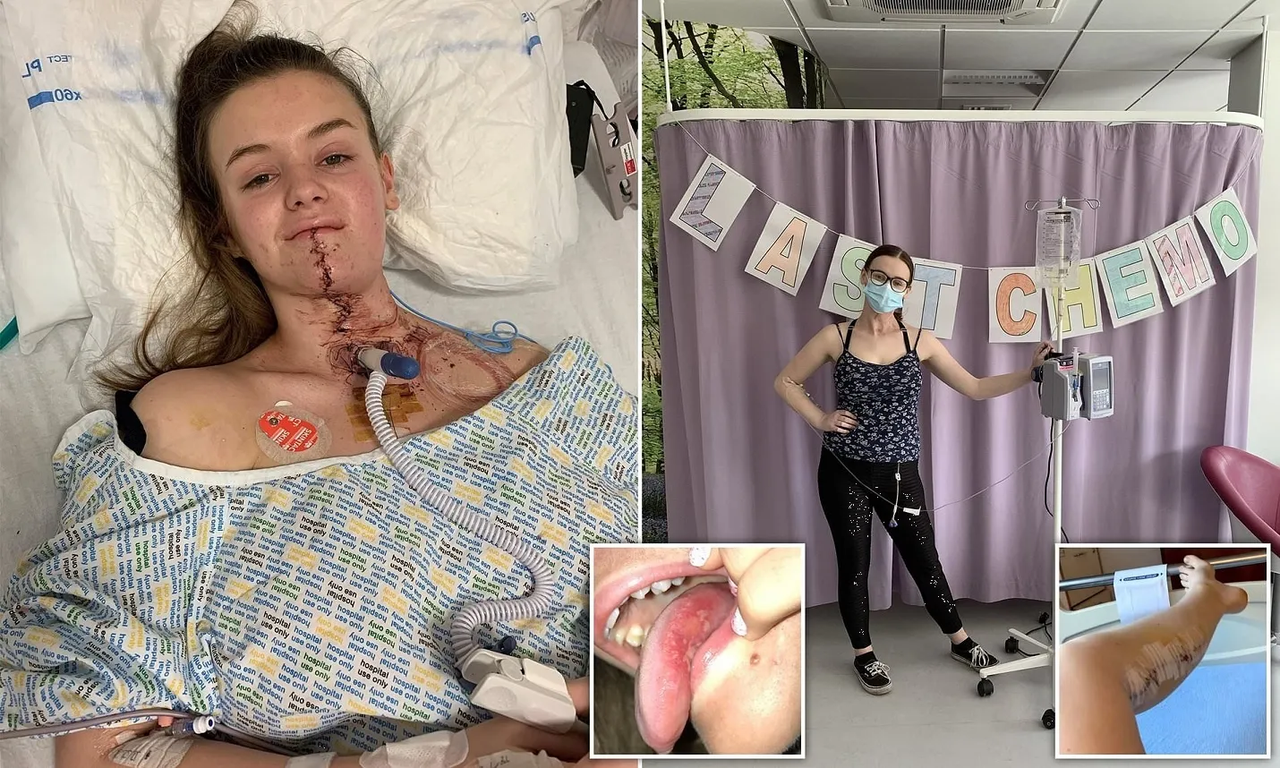 Mujer pierde la lengua por un cáncer, la diagnosticaron mal un año atrás