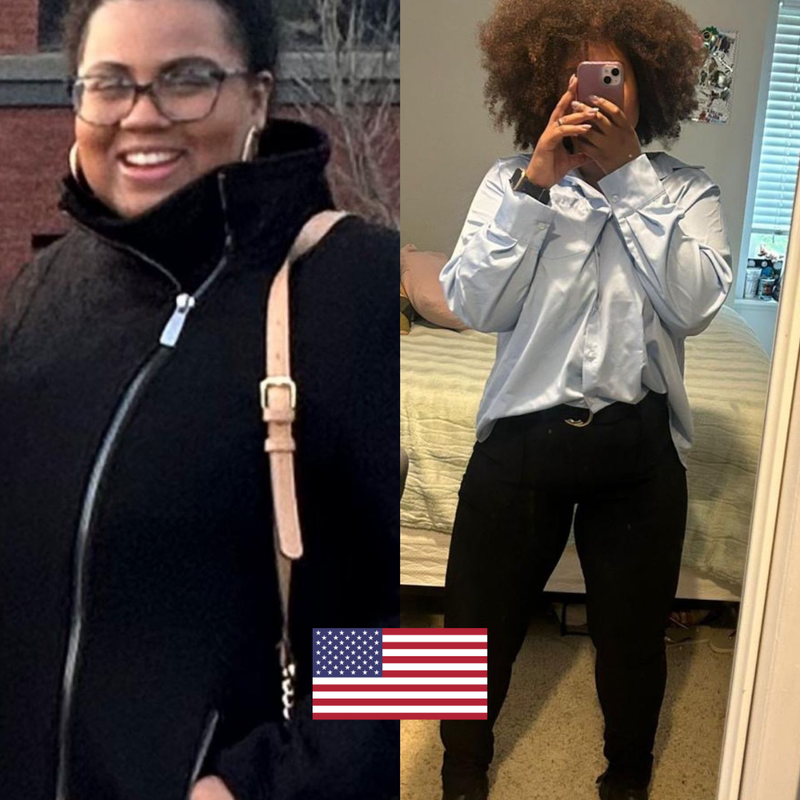 Antes e Depois - Depoimento 7