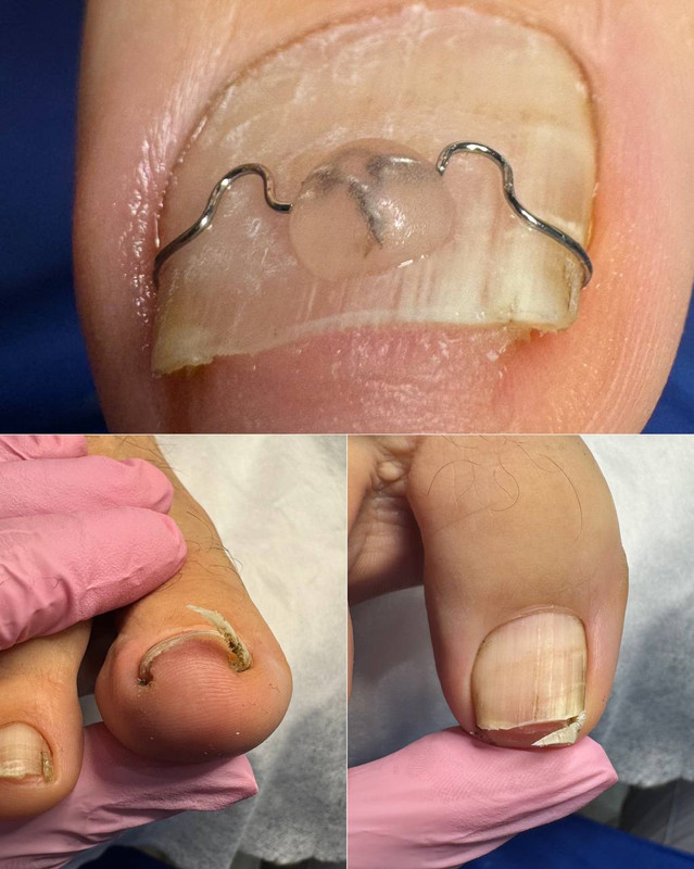 подология 6