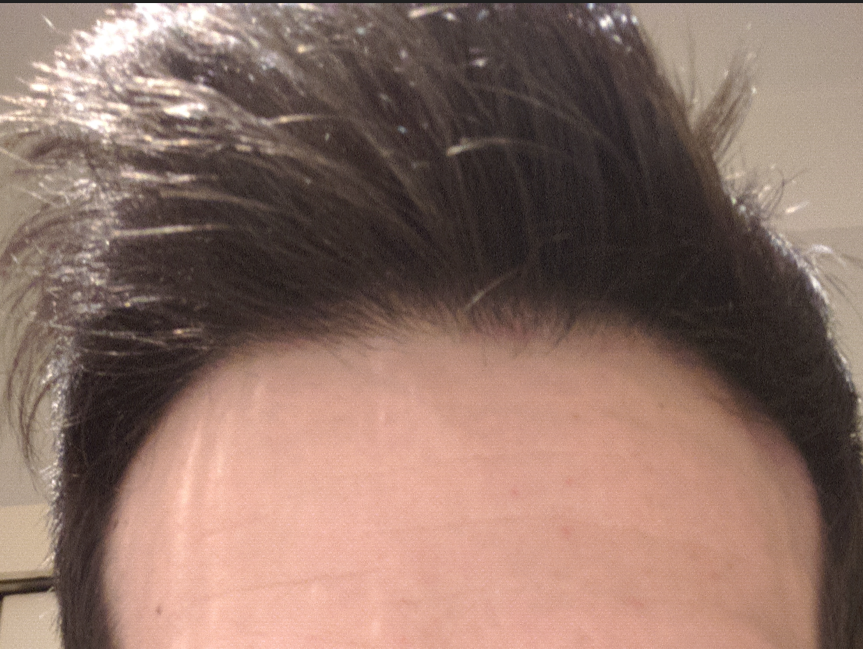 6. marzo 2020. Potete notare come stava decisamente meglio il front. A pochi mesi dlla ripresa di Fi