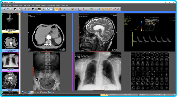 Sante-DICOM-Viewer-Pro-11-9-3.png