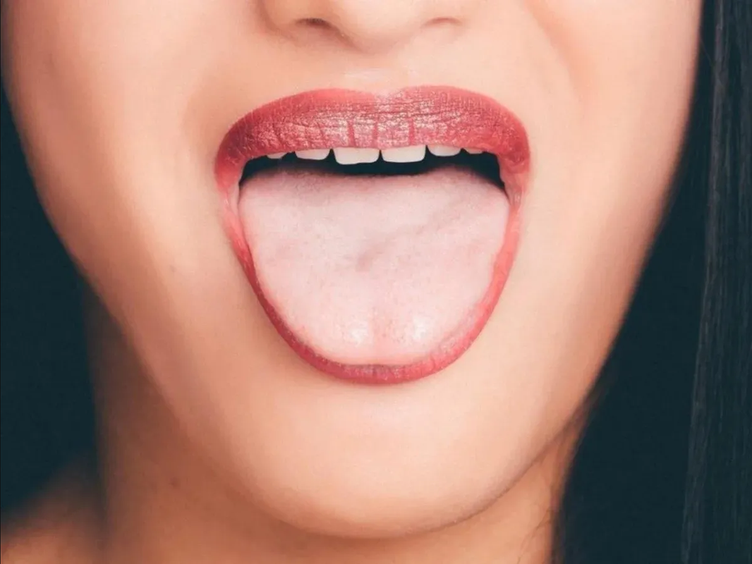 Tengo la lengua blanca ¿es algo malo?