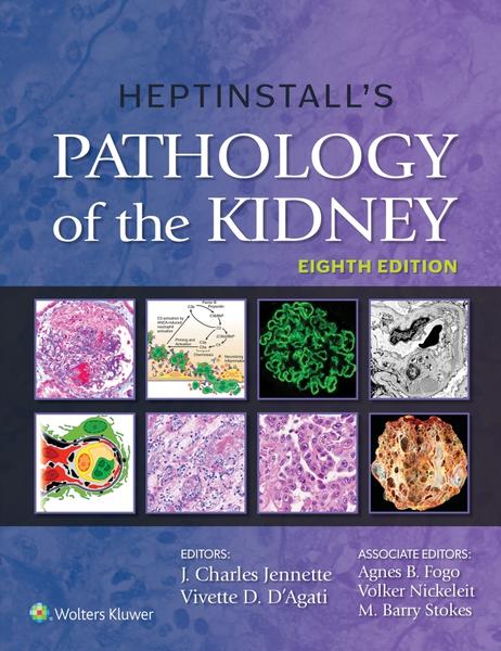 Heptinstall’s Pathology Of The Kidney 8th Edition (J. Charles Jennette, MD, Vivette D. D’Agati, MD) Heptinstall’s Pathology Of The Kidney 8th Edition (J. Charles Jennette, MD, Vivette D. D’Agati, MD)