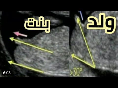 554DFBE6-3C1C-471D-8D5A-565C57BB3B00