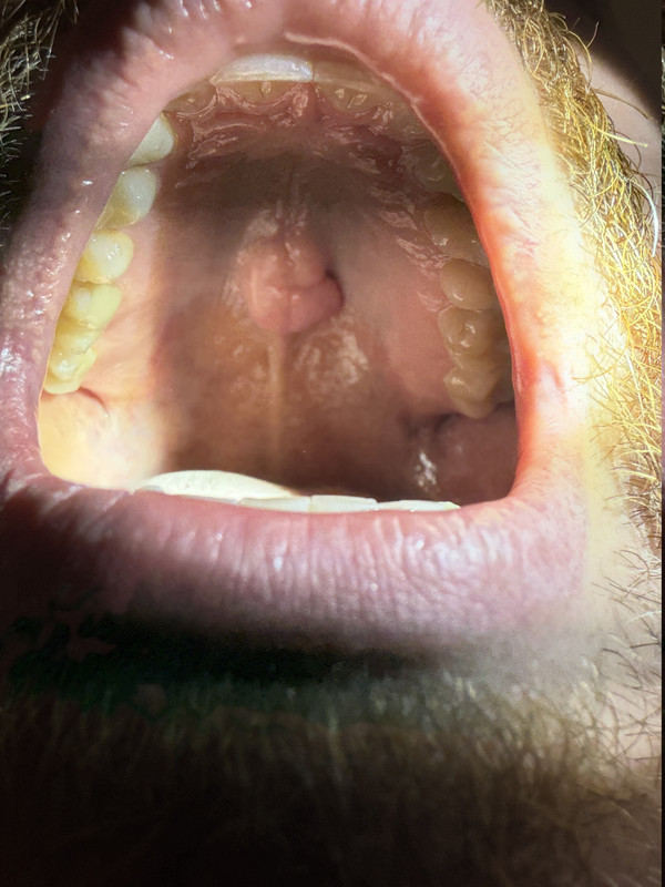 IMG 1066