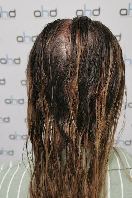 11после спина