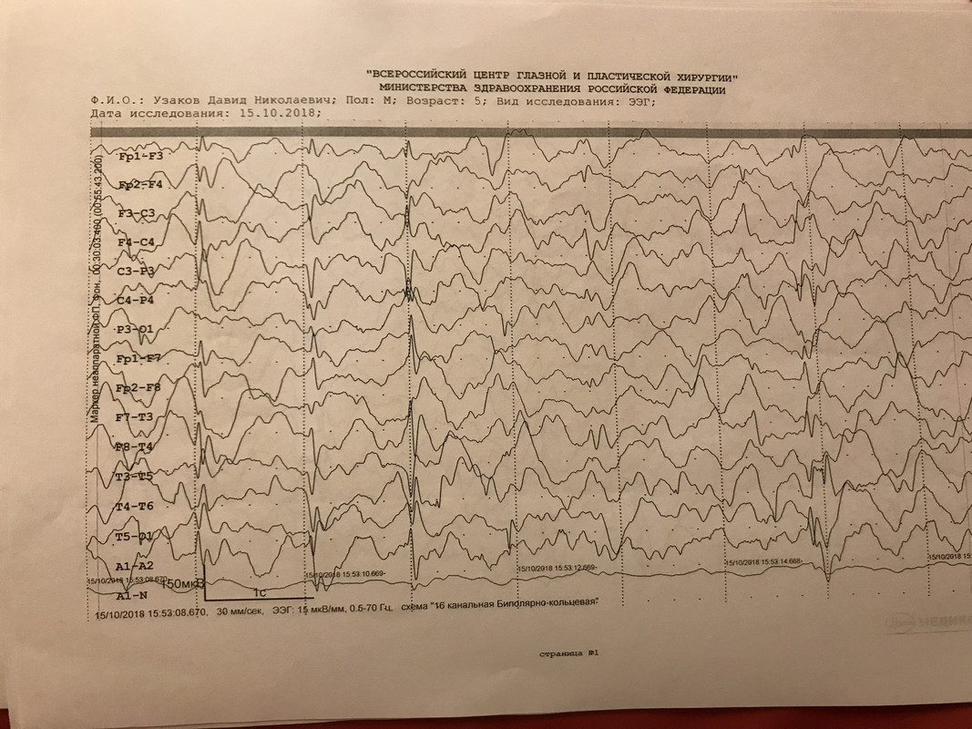 Ээг саратов. Норма ЭЭГ В 7 лет. ЭЭГ головного мозга ребенку 9 лет норма. ЭЭГ норма у детей 4 лет. График ЭЭГ норма у детей.
