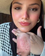 Skin Revive Result 1