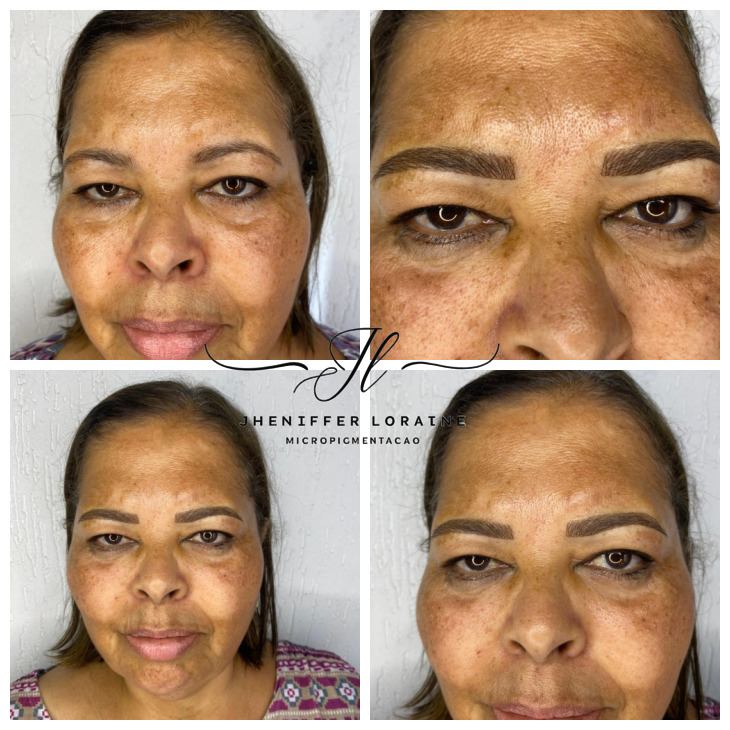 Antes e depois micropigmentação sobrancelhas