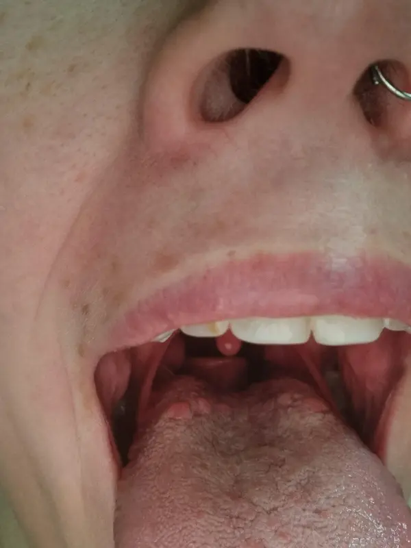 6-years-searching-for-diagnosis-just-found-multiple-v0-8sr3car8xyod1