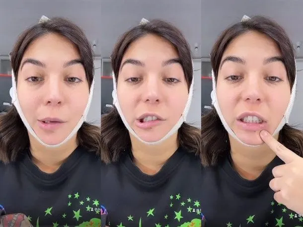 Influencer sufre parálisis facial tras cirugía estética mal realizada