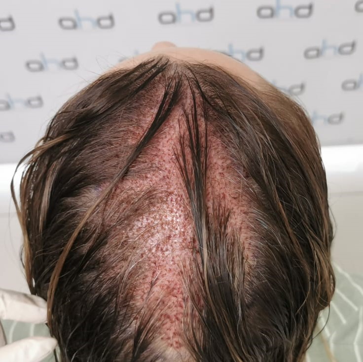 10после верх