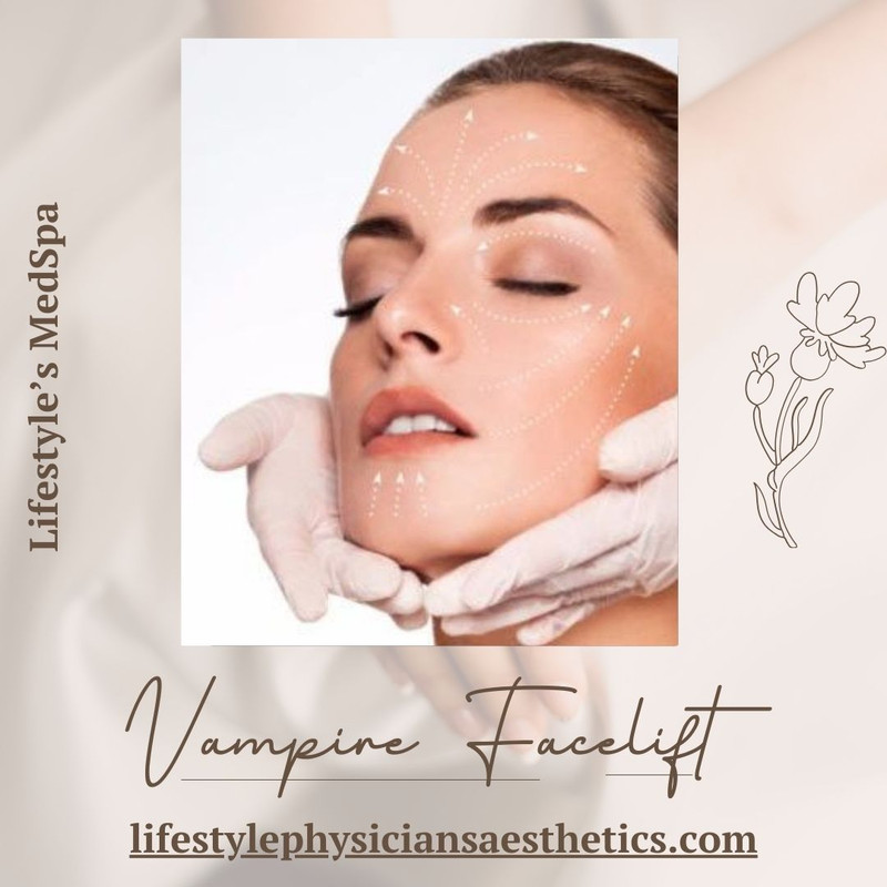 Vampire Facelift (1)
