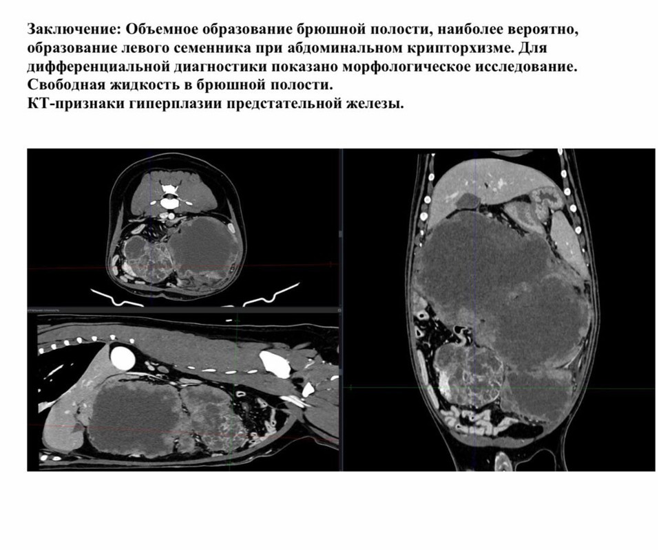 кт локи (2)