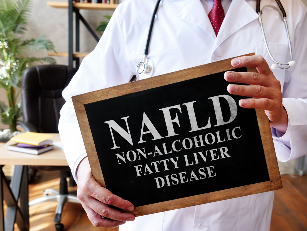Non-alcoholic fatty liver disease NAFLD