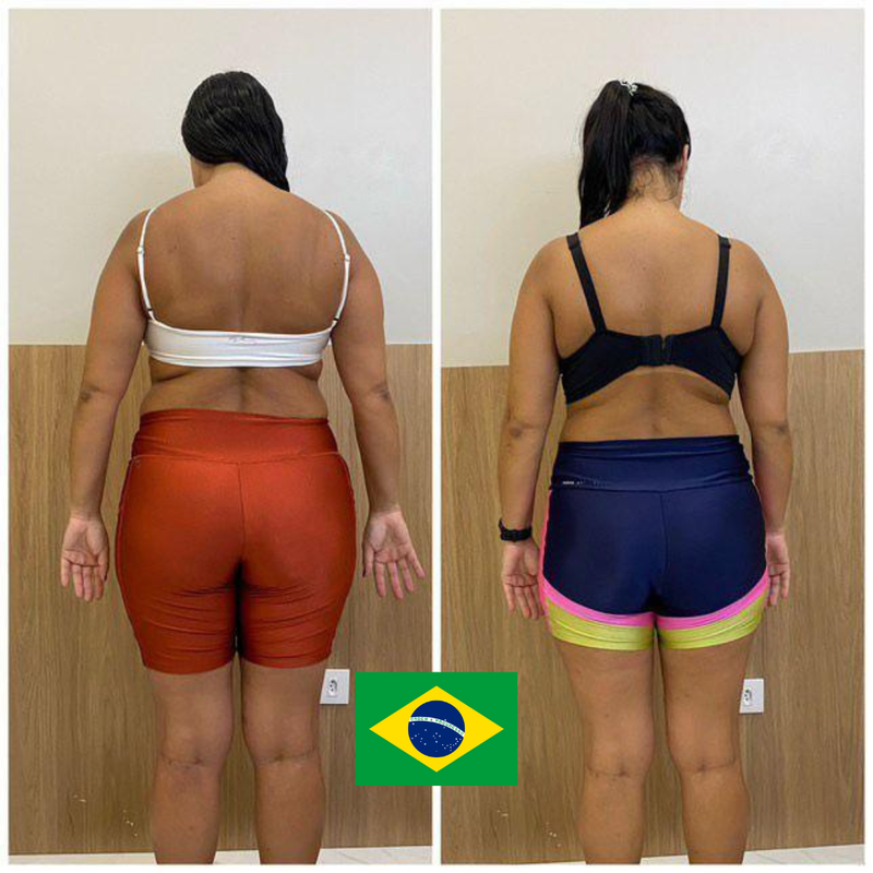 Antes e Depois - Depoimento 2