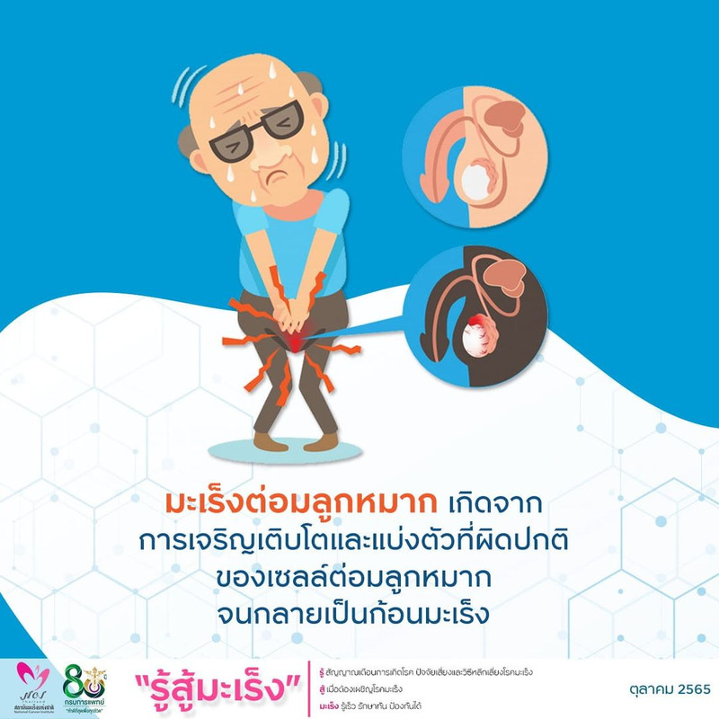 สาเหตุมะเร็งต่อมลูกหมาก