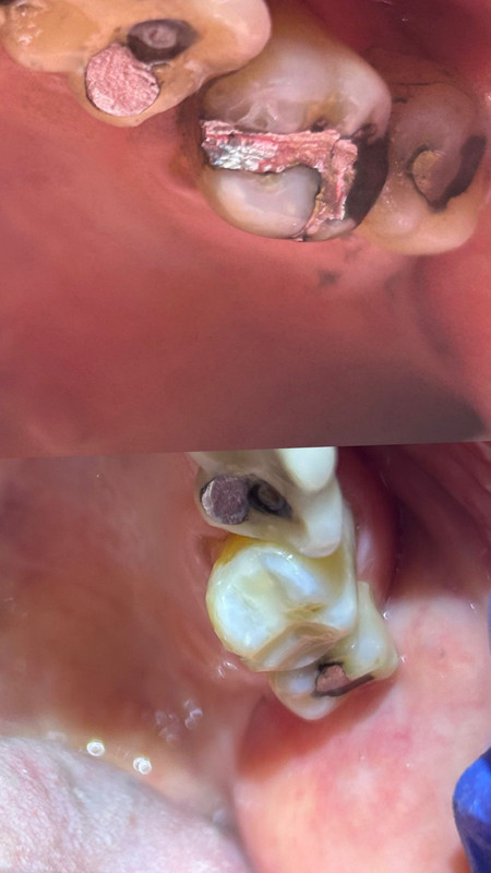 Transformação do Sorriso