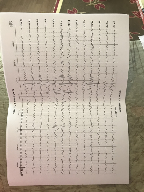 A49A71D5-08C2-4D0D-8D71-352BEF59EB2E