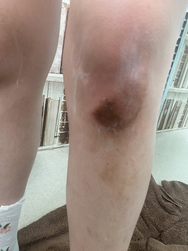 7A4B2062-4267-46DC-AFE3-D43873B148AB