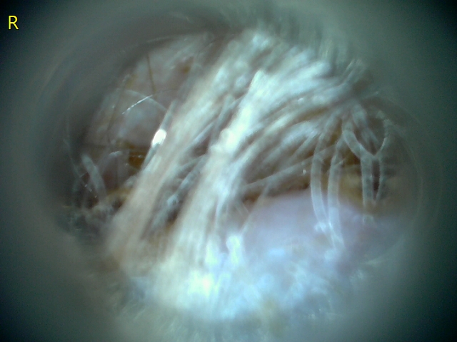 23207 177215 Into CNS 000008