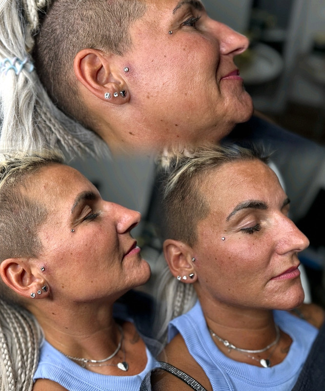Popis obrázku