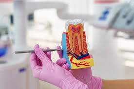 Post-Treatment Wellness: Are Root Canals Bad for You During Recovery?