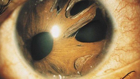 Medical & Surgical Treatment of Glaucoma Medical & Surgical Treatment of Glaucoma