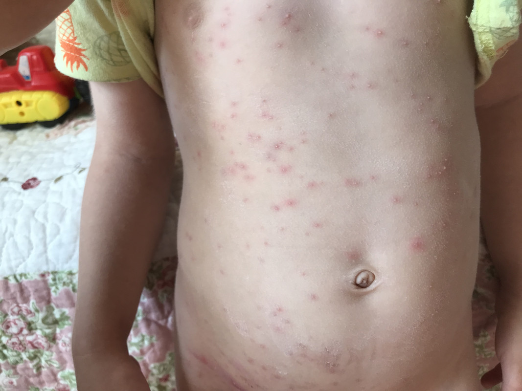 6114848A-F8D7-42B1-85E4-3BB6642C8449