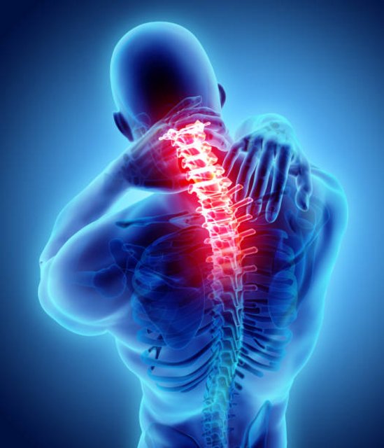 Spinal Cord Stimulation