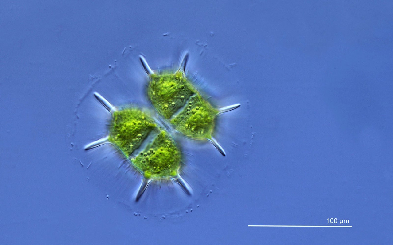 Xanthidium 01 antilopeum Gazellenalge Schleimhülle mit Bakterien DIK 40 Gieringer Moor-Z7