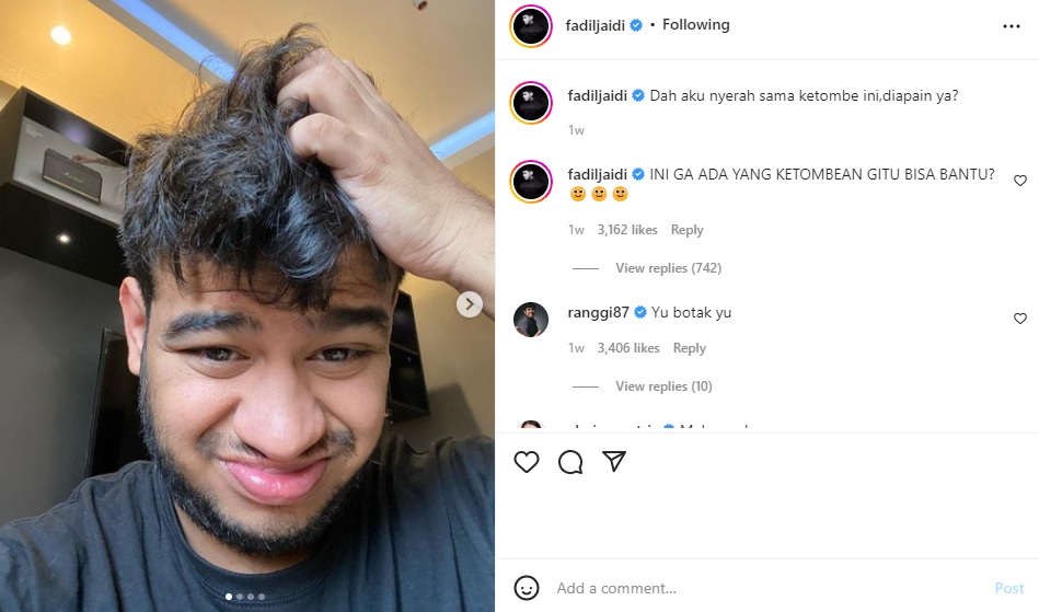 Fadil Jaidi mengeluh soal masalah ketombenya hingga tagar #ketombeviral viral.