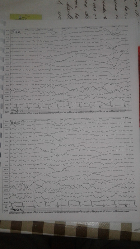 1510522662341-1900865464