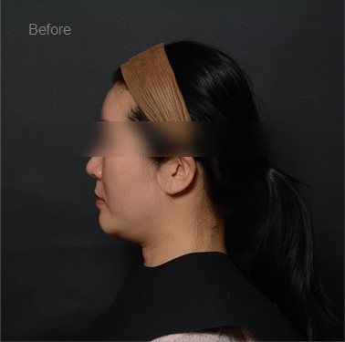 Pre-Treatment Clinical State