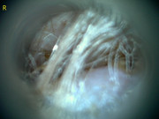 23207 177215 Into CNS 000008